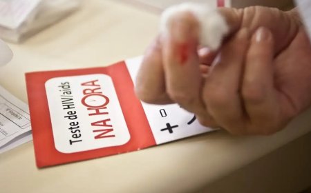 Bahia desmente surto de HIV/Aids em jovens do estado