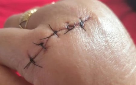 Professora é atacada com faca por aluna de 14 anos durante aula: 'Vou te matar'