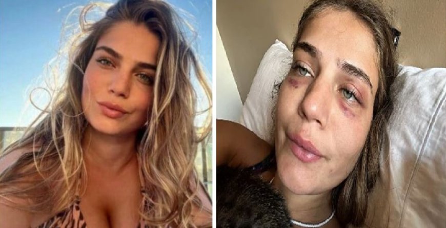 Modelo relembra agressões de jogador: ‘me agredia e abusava sexualmente’