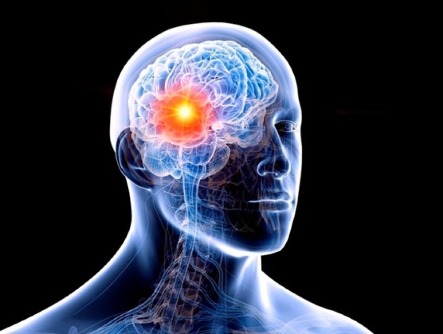 Tumor cerebral: veja 4 sinais que o corpo dá e você não deve ignorar