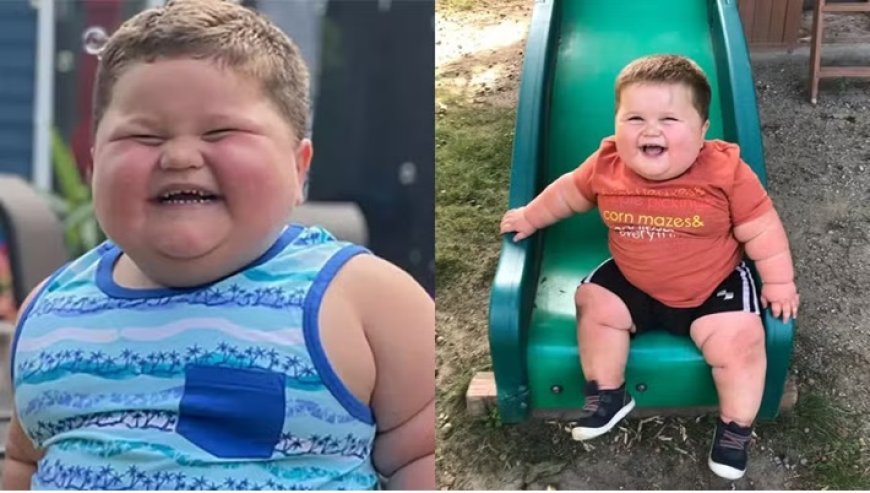 Menino de 3 anos pesava 45 quilos por causa de doença rara que o fazia chorar de fome o dia todo