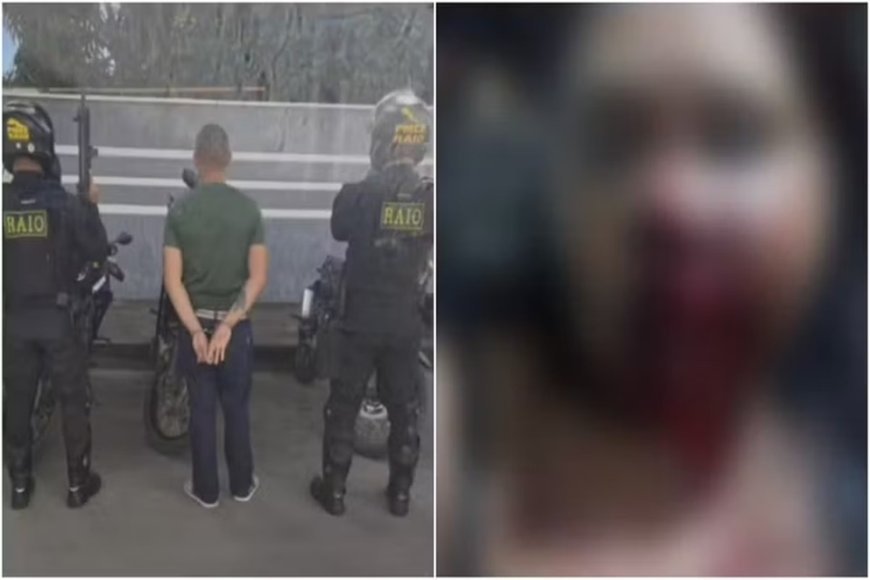 Homem é preso após desfigurar rosto da companheira com socos e facadas