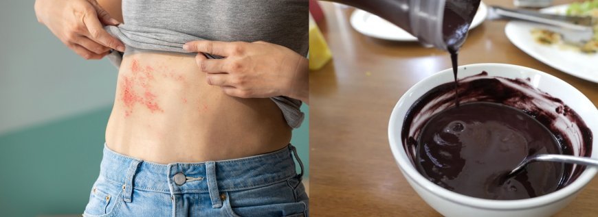 Açaí pode causar doença de Chagas? Entenda polêmica da COP30