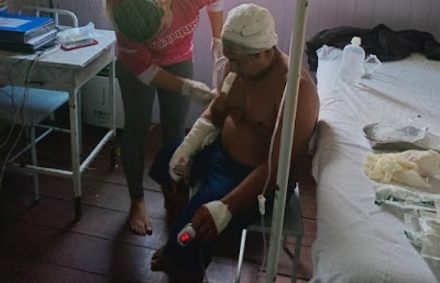 Cacique sobrevive a ataque de onça em comunidade indígena no Amazonas