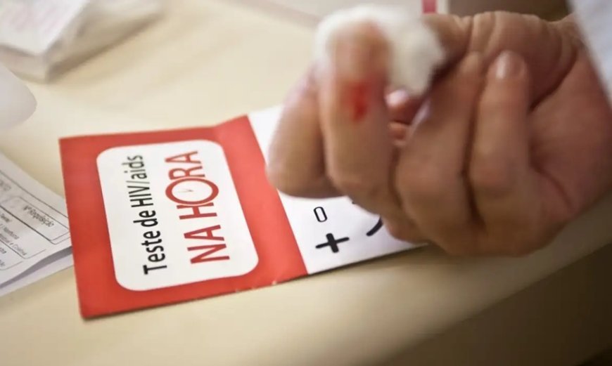Bahia desmente surto de HIV/Aids em jovens do estado