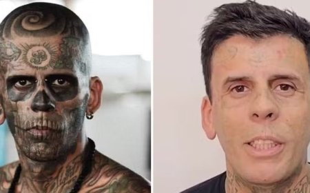 Homem ‘mais tatuado do Brasil’ vira evangélico e surge irreconhecível após sessões de remoção a laser; veja