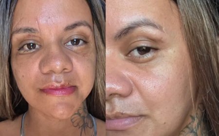 Após 30 dias da cirurgia, Juliana Garcia mostra rosto reconstruído após agressão brutal do ex-namorado