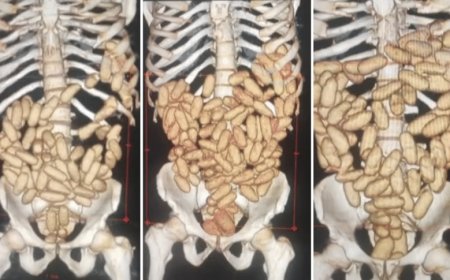 PF prende quatro passageiros com cápsulas de cocaína no estômago