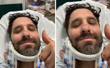 Rafinha Bastos sofre acidente e é levado às pressas ao hospital: "Apaguei no meio da rua"