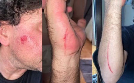 Motorista de aplicativo é atacado com facão por passageiro durante corrida