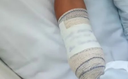 Menino de 8 anos tem mão amputada ao confundir explosivo com pedal no Rio