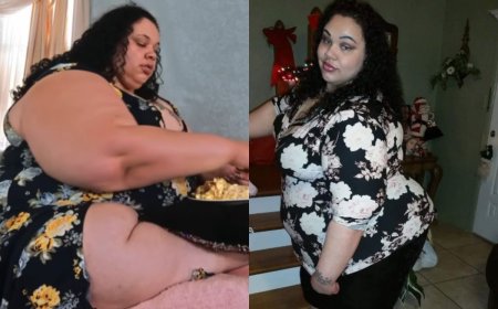 Veja antes e depois de ex-estrela de reality que pesava 289 quilos