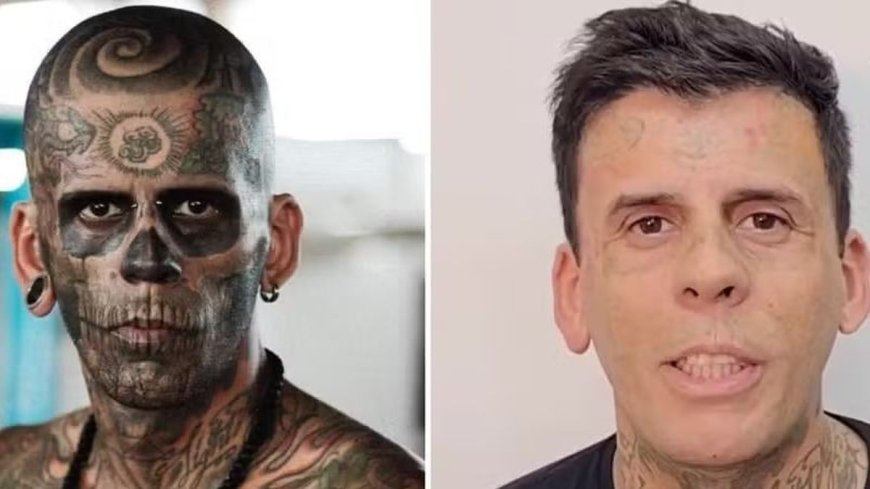 Homem ‘mais tatuado do Brasil’ vira evangélico e surge irreconhecível após sessões de remoção a laser; veja