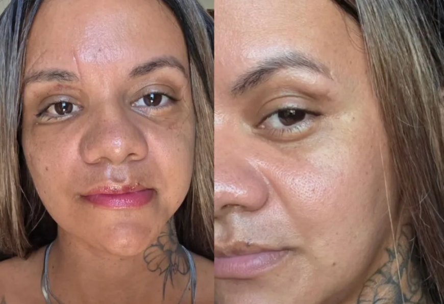 Após 30 dias da cirurgia, Juliana Garcia mostra rosto reconstruído após agressão brutal do ex-namorado