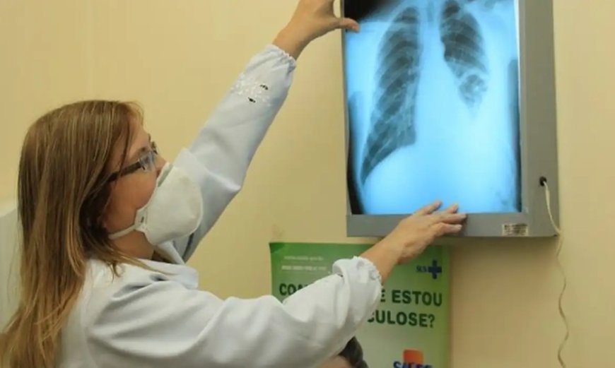 Saiba mais sobre a alergia, que pode ser causada por diversos fatores