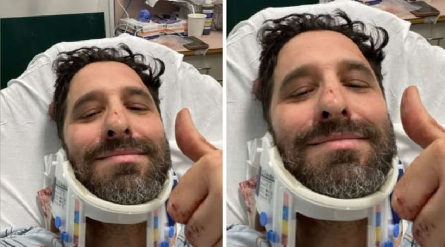 Rafinha Bastos sofre acidente e é levado às pressas ao hospital: "Apaguei no meio da rua"