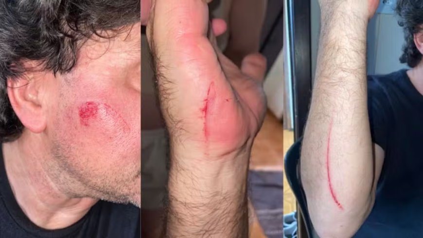 Motorista de aplicativo é atacado com facão por passageiro durante corrida
