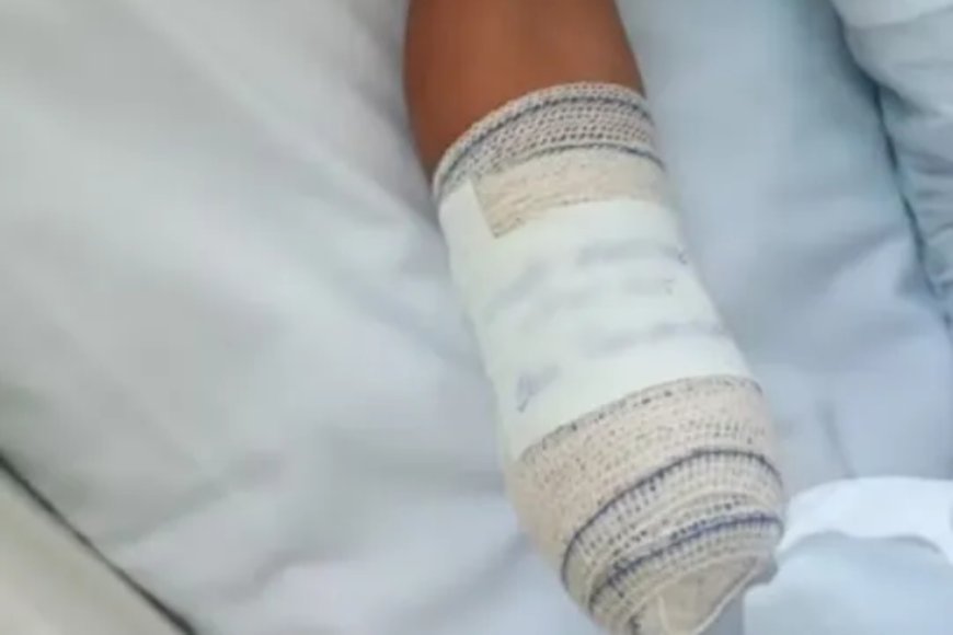 Menino de 8 anos tem mão amputada ao confundir explosivo com pedal no Rio