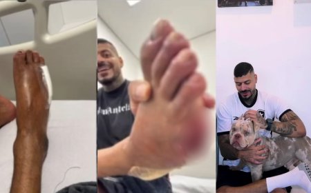 Cachorro come dedo de influenciador enquanto ele dormia