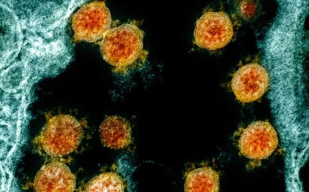 Infogripe alerta para Síndrome Respiratória Aguda Grave em 14 estados