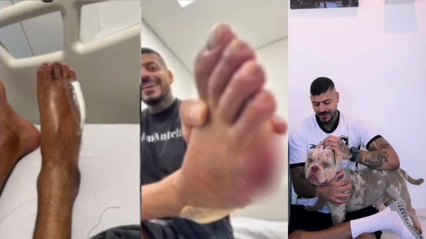 Cachorro come dedo de influenciador enquanto ele dormia