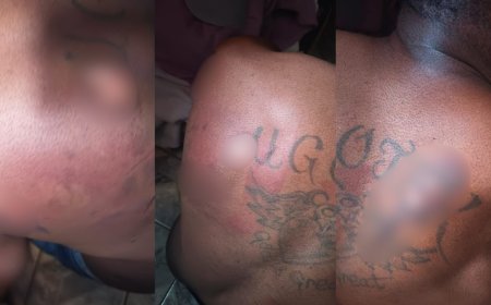 Nigerianos são presos por sequestrar e torturar rapaz com ferro de passar