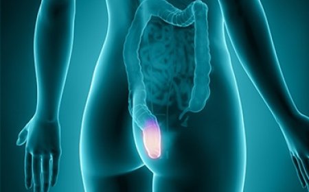 Após câncer raro, mulher tem o ânus e a vulva amputados