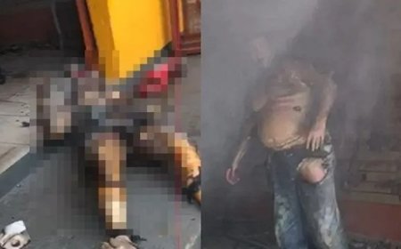 Homem ateia fogo na esposa por ciúmes dentro de loja