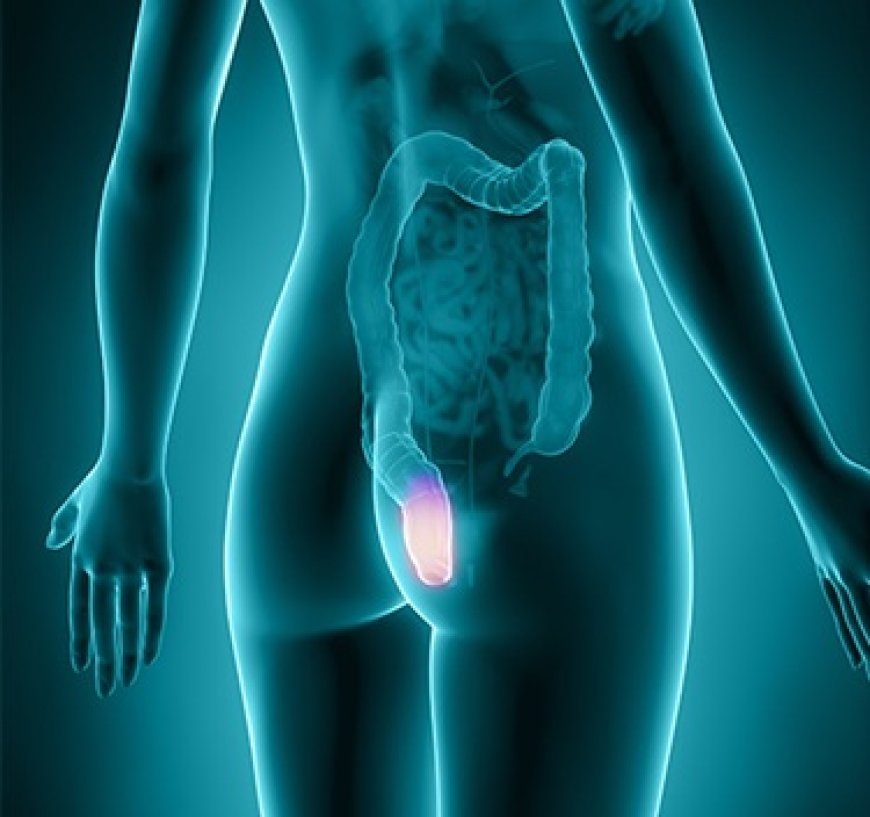 Após câncer raro, mulher tem o ânus e a vulva amputados