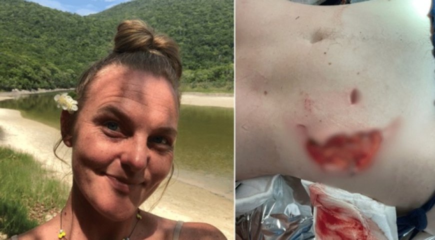 “Dor violenta”: Mulher é atacada por capivara e tem parte de nádega arrancada