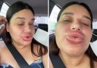 Maquiadora fica com lábios gigantes após retirar preenchimento e viraliza ao rir da situação: 'Lindíssima'