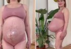 Barriga pontuda de grávida de trigêmeas viraliza na internet