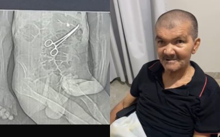 Idoso morre na véspera de Natal após pinça ser esquecida em seu corpo em MG