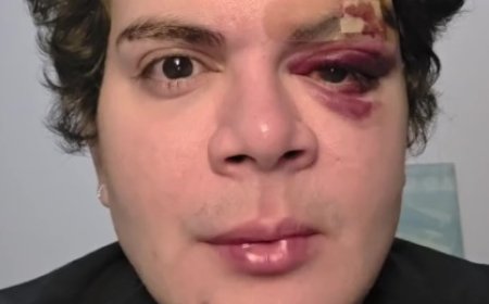 Médico denuncia agressão homofóbica após ter apartamento invadido no Recife