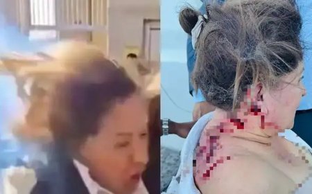 Vídeo: Deputada é atingida na cabeça por explosivo e fica gravemente ferida