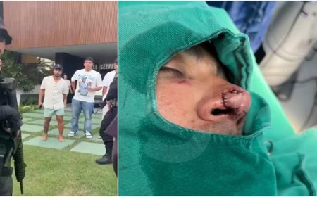 Vizinho foi mordido no nariz por atleta do Fortaleza durante briga em condomínio