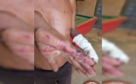 Homem é brutalmente agredido com facão pelo próprio filho