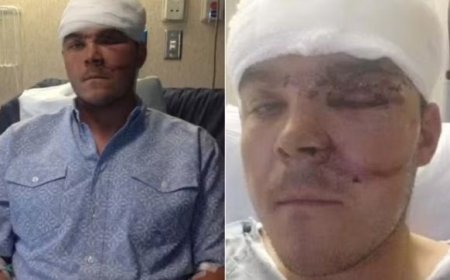 Caçador sobrevive a ataque de urso após colocar o braço inteiro na garganta do animal