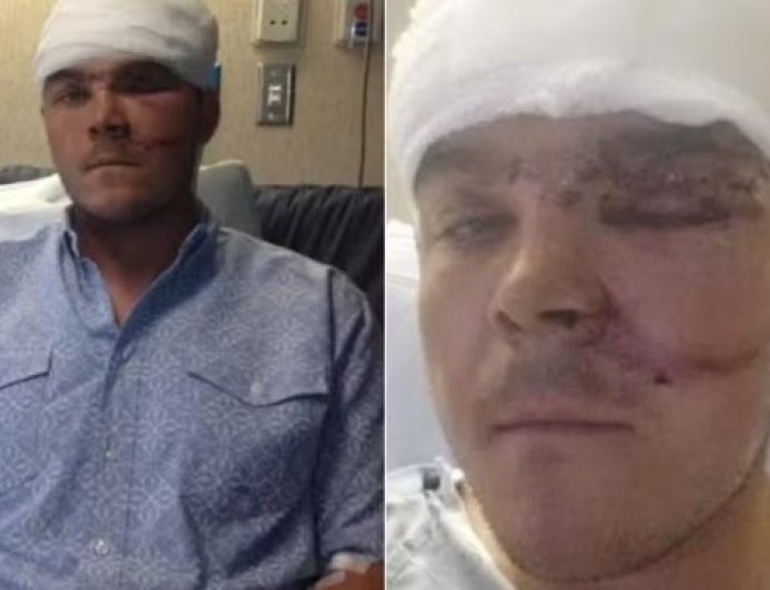 Caçador sobrevive a ataque de urso após colocar o braço inteiro na garganta do animal