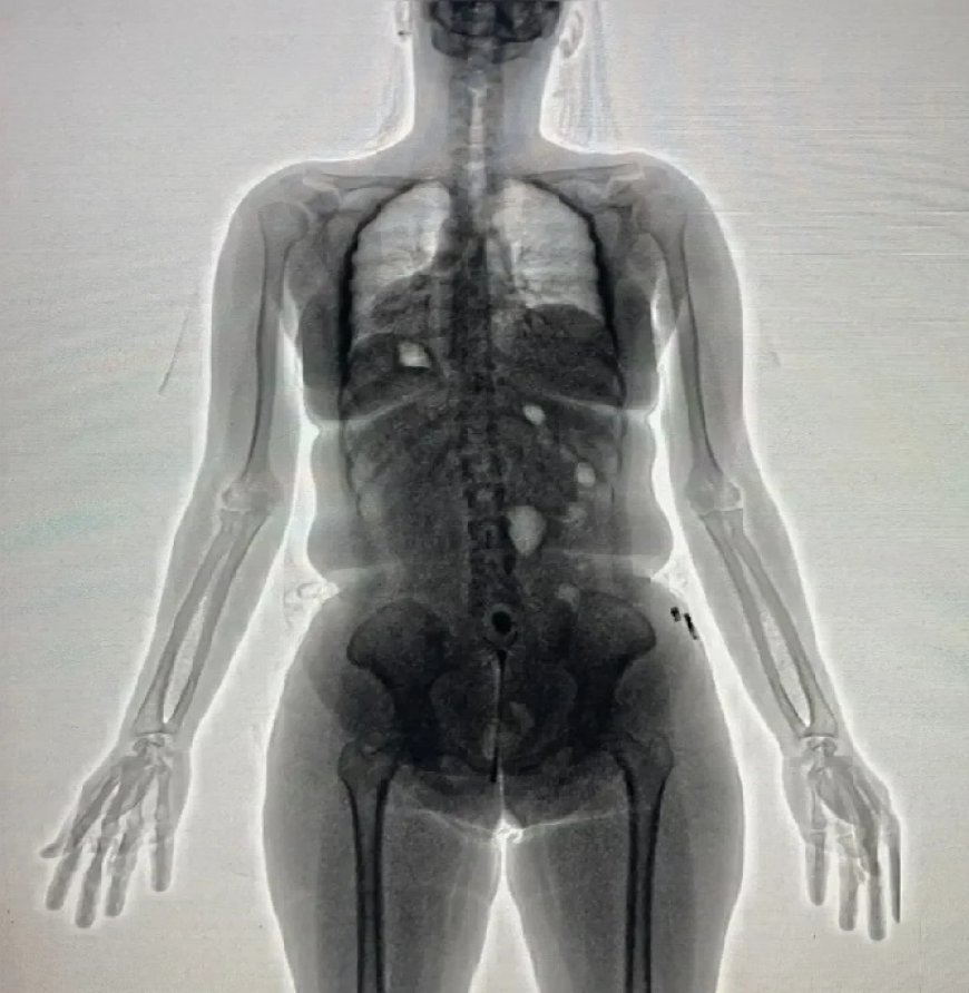 Mulher esconde drogas na vagina e é presa ao tentar entrar em presídio baiano