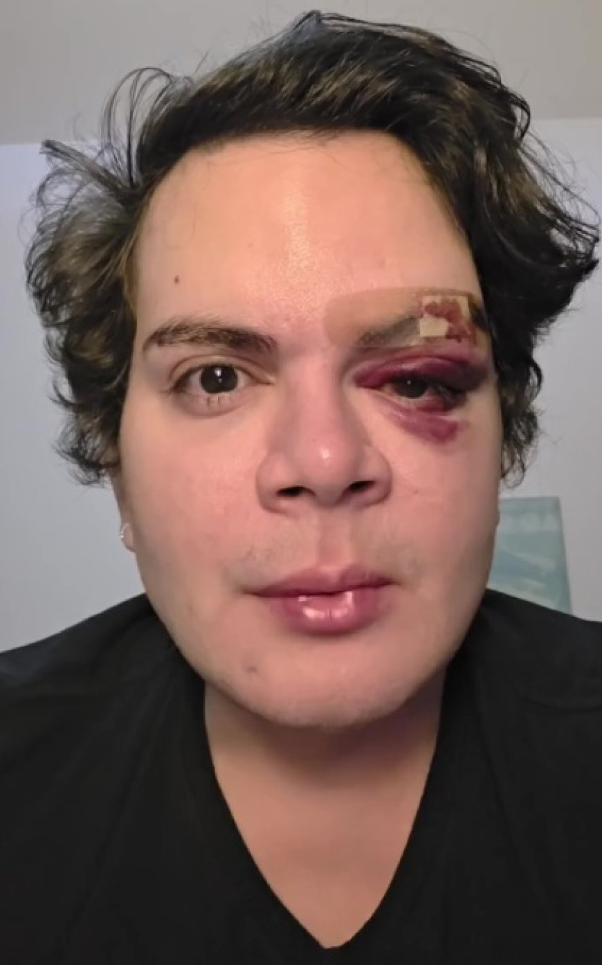 Médico denuncia agressão homofóbica após ter apartamento invadido no Recife