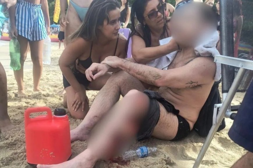 Atropelado por lancha, banhista tem perna lacerada no litoral de SP