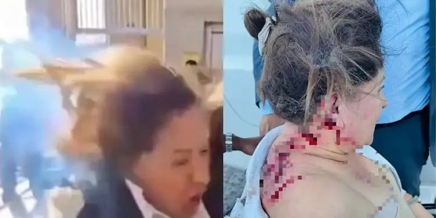 Vídeo: Deputada é atingida na cabeça por explosivo e fica gravemente ferida