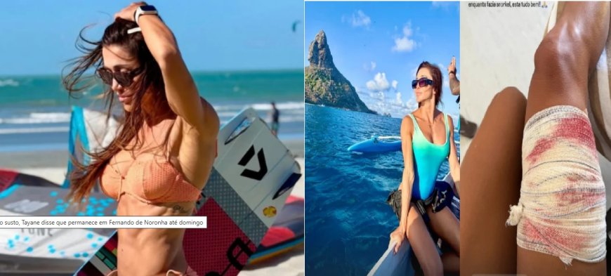 Advogada é mordida por tubarão ao fazer snorkel em Fernando de Noronha