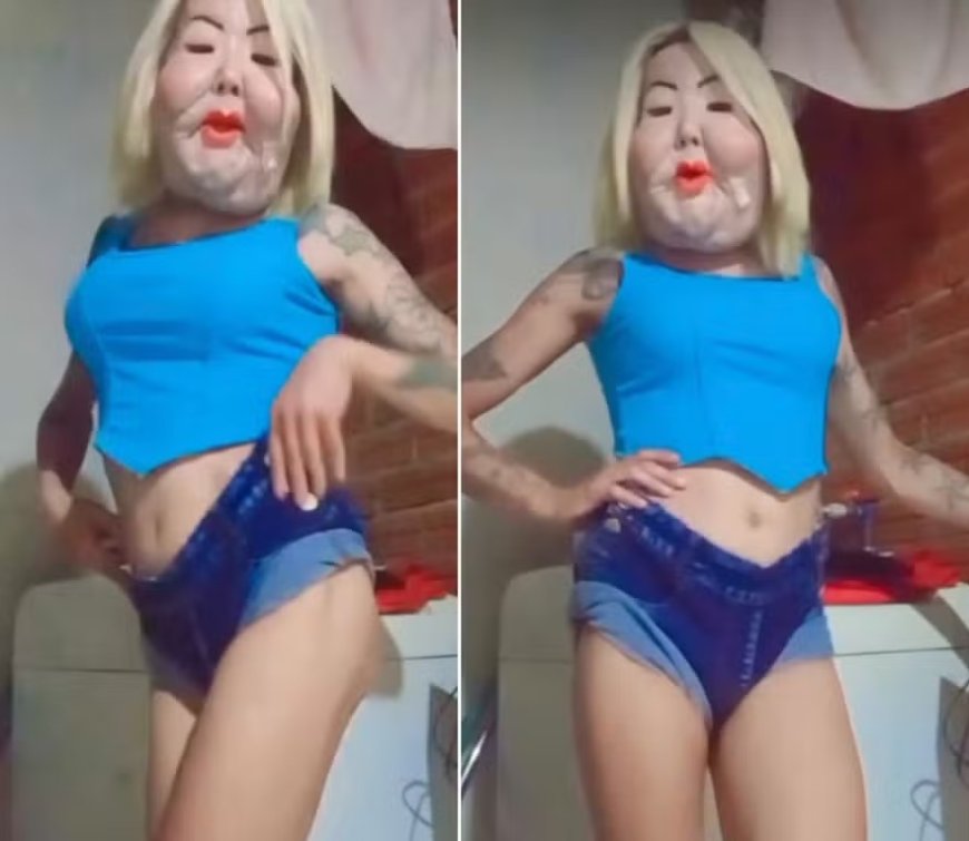 Juju do Pix exibe resultado da cirurgia para retirar óleo mineral do rosto e se gaba: 'Um corpo é um corpo'