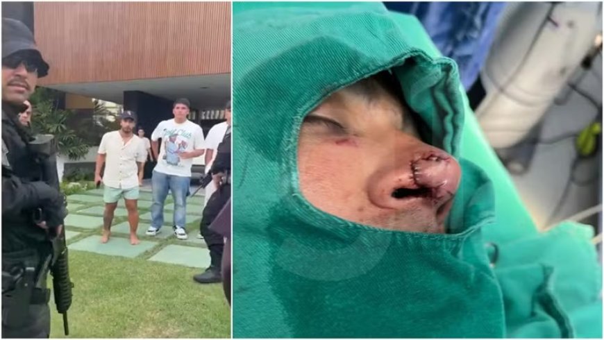Vizinho foi mordido no nariz por atleta do Fortaleza durante briga em condomínio