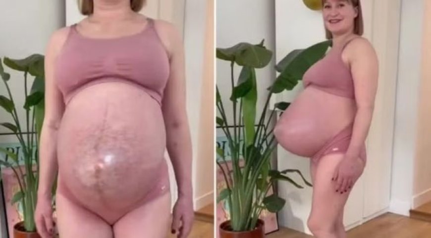 Barriga pontuda de grávida de trigêmeas viraliza na internet