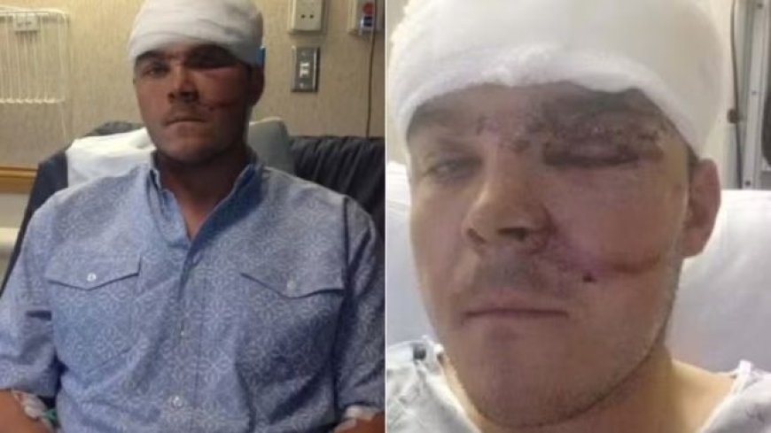 Caçador sobrevive a ataque de urso após colocar o braço inteiro na garganta do animal