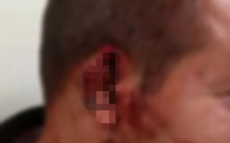 Mulher acusada de arrancar orelha de homem e jogar no lixo é presa