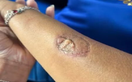 Mãe agride funcionárias e morde vice-diretora dentro de colégio estadual